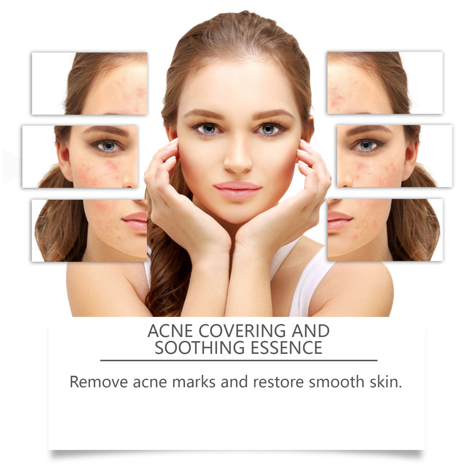 Acne Soothing Serum Hydrating Moisturizing Facial Skin Care Solution