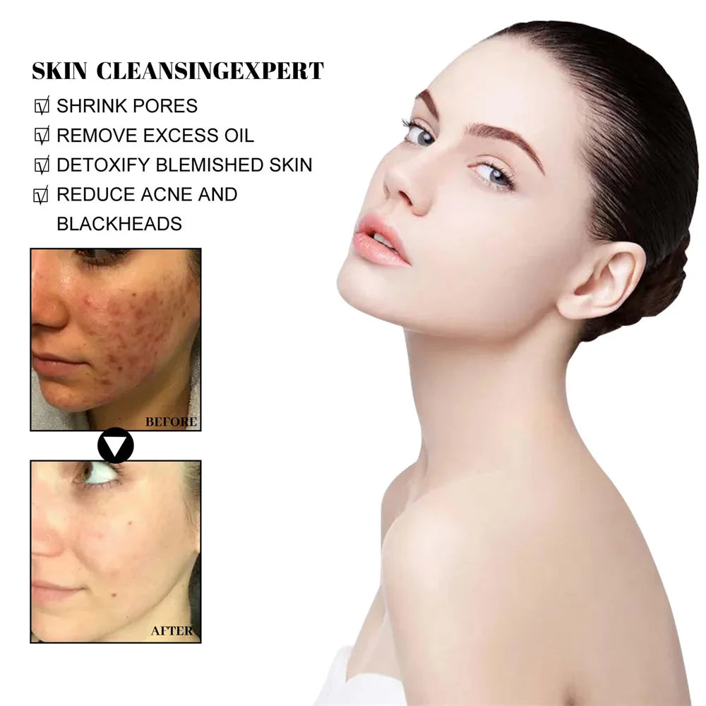 Blackhead Removal Mud Mask Oil Control Pore Care